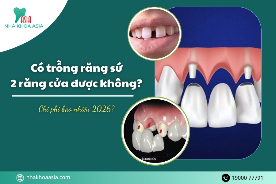 Có trồng răng sứ 2 răng cửa đuọc không? Chi phí bao nhiêu?