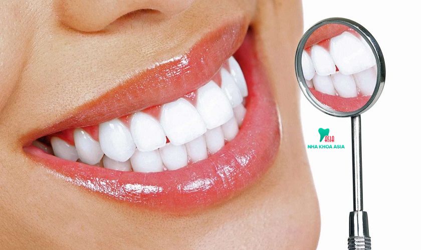 Trồng răng sứ vĩnh viễn là gì?