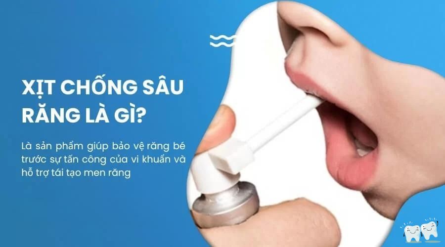 Thuốc xịt chống sâu răng cho bé?