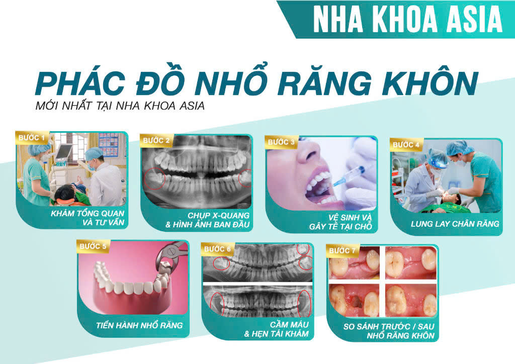 Quy trình nhổ răng khi đang mang thai tại Nha khoa Asia