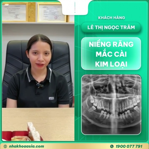 Khách hàng Lê Thị Ngọc Trâm niềng răng mắc cài kim loại tại Nha Khoa Asia