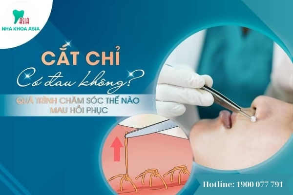 Cắt chỉ răng khôn có đau không? Bác sĩ Nguyễn Văn Tưởng chia sẻ