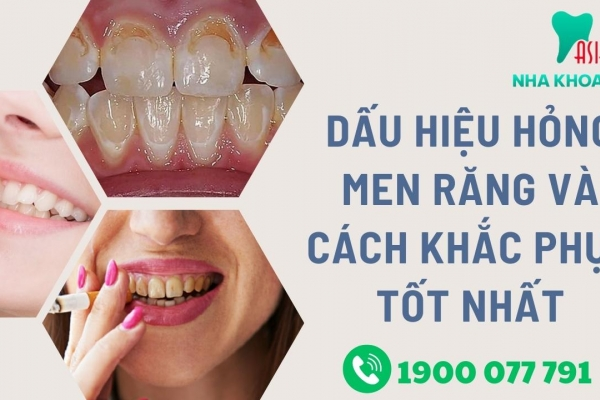 [Cảnh báo] - Men răng hỏng có phục hồi được không? Lời khuyên từ Bác sĩ Nguyễn Văn Tưởng