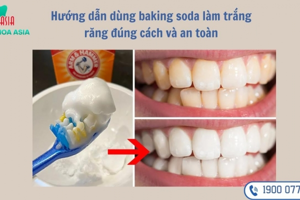Răng trắng sáng nhờ baking soda - Bí quyết ít ai biết để răng trắng sáng bật tông ngay tại nhà