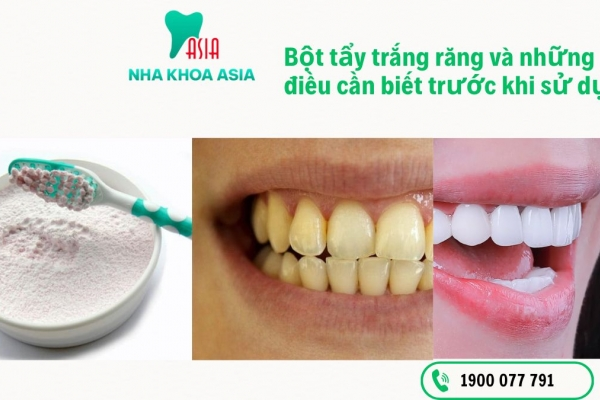 Bột tẩy trắng răng là gì? [Đọc Ngay] để tránh những sai lầm nguy hiểm