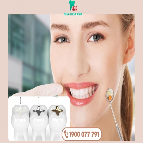 Trám răng giữ được bao lâu và những yếu tố ảnh hưởng?