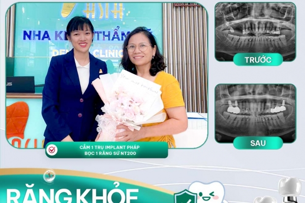 Dịch Vụ Trồng Răng Implant và Răng Sứ Tại Nha Khoa Asia