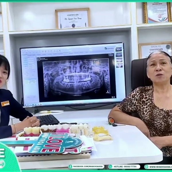 Cảm nhận của Cô Phạm Thị Vân khi trồng răng implant & Bọc răng sứ tại Nha khoa Asia