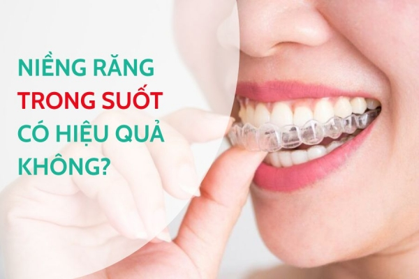 Niềng Răng Trong Suốt Có Hiệu Quả Không? Ưu Và Nhược Điểm Bạn Cần Biết
