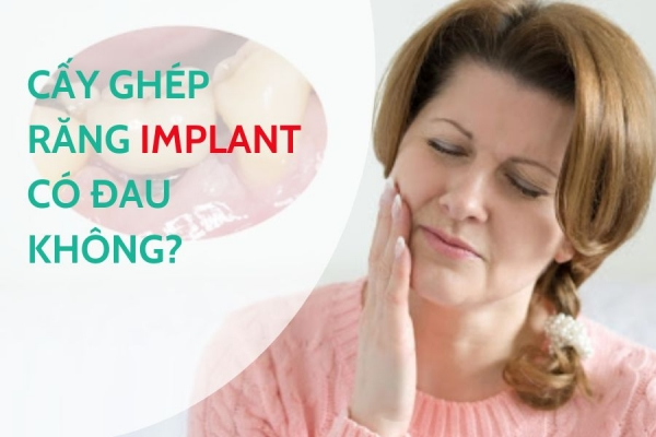 Cấy Ghép Răng Implant Có Đau Không? 3 Cách Giảm Đau Hiệu Quả 2026