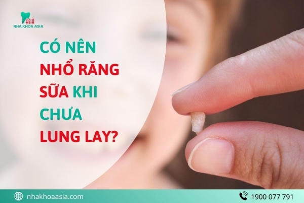 Có Nên Nhổ Răng Sữa Khi Chưa Lung Lay? Bác Sĩ Khuyến Cáo Cha Mẹ Nên Biết