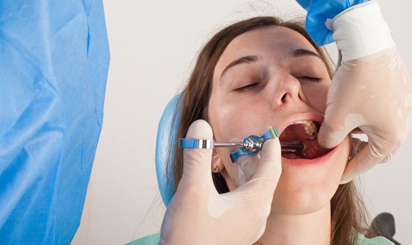 Các yếu tố quyết định việc trồng răng Implant có đau không