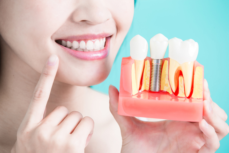 Trồng răng Implant (cấy ghép Implant) là gì?