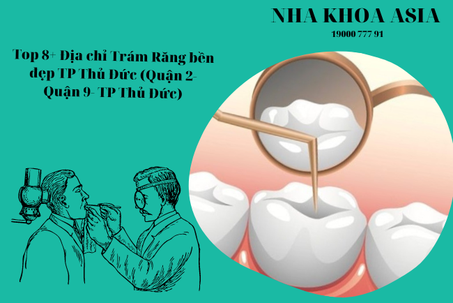 Những ưu đãi đặc biệt của Nha khoa Asia trong việc trám răng tại Thủ Đức?
