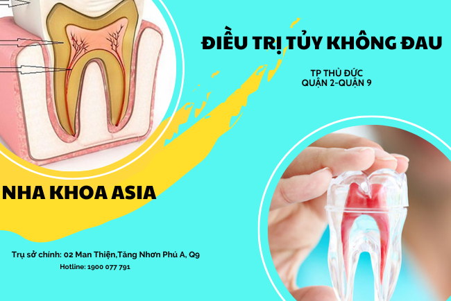 điều trị tủy răng không đau tp thủ đức quận 2 quận 9