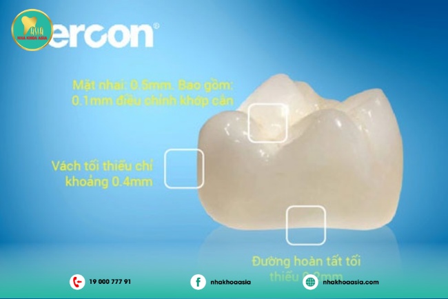 Răng sứ Cercon