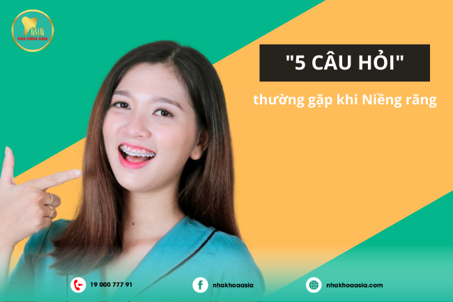 5 câu hỏi thường gặp khi niềng răng