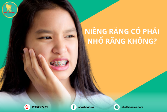 niềng răng có phải nhổ răng không