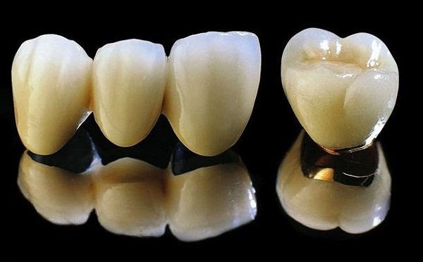 Ưu điểm và nhược điểm của các loại răng bọc sứ hiện nay