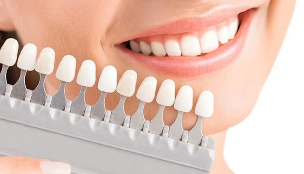 Làm răng bọc sứ có tốt hay không?