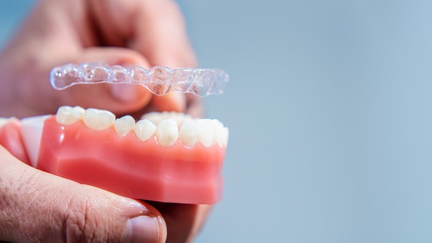 Niềng răng 3D Clear có hiệu quả không?