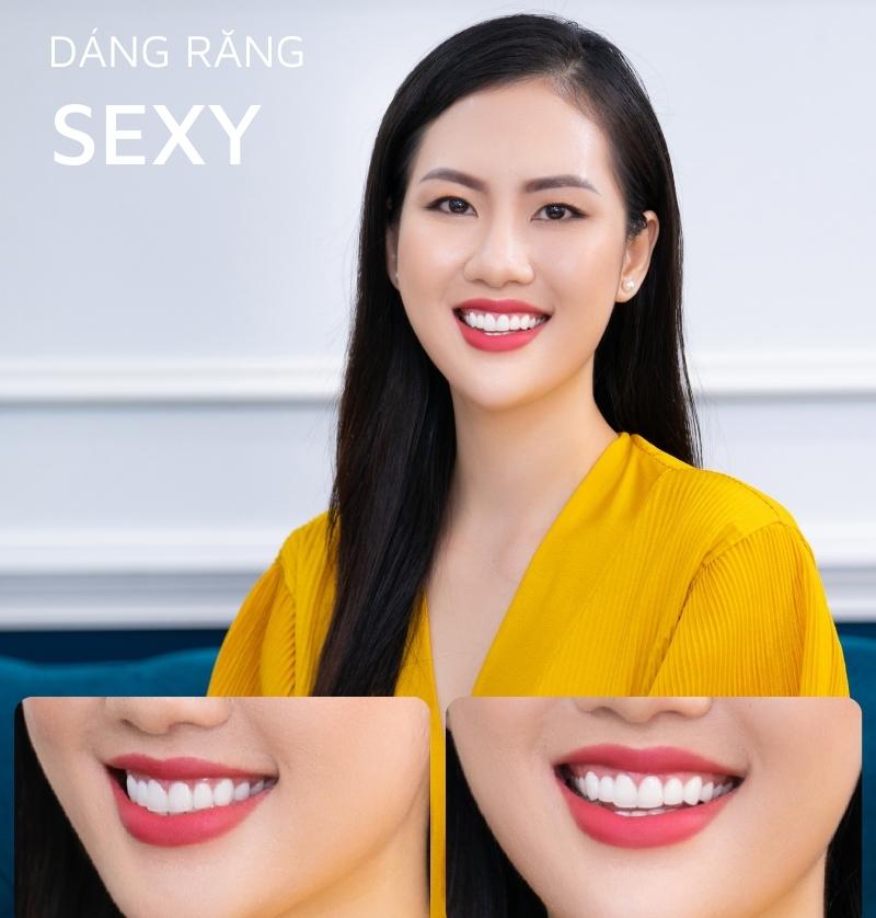 Dáng răng sexy