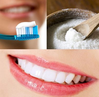 cách tẩy trắng răng giá rẻ