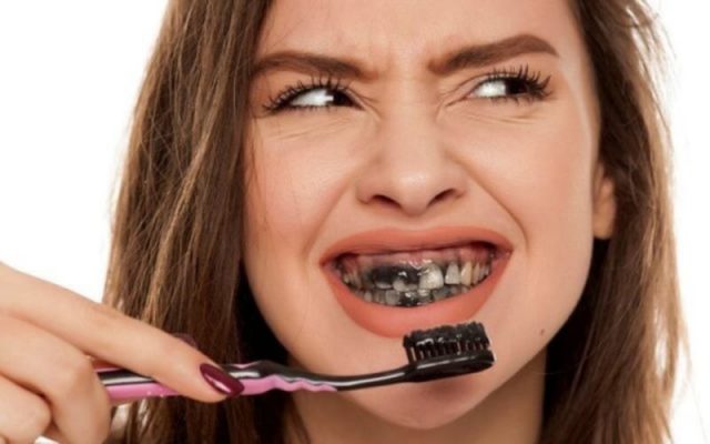 cách tẩy trắng răng giá rẻ