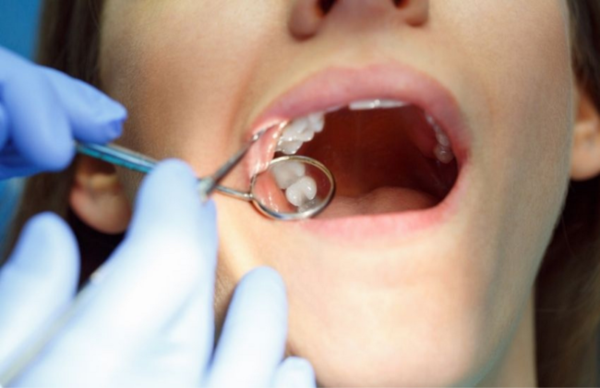 Nhổ răng khôn sưng bao lâu?