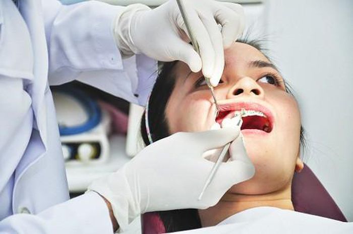 Nhổ răng khôn hàm trên có gây nguy hiểm hay không?
