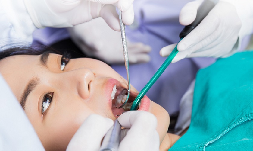 Trường hợp nào không cần tiến hành nhổ bỏ răng khôn hàm trên?