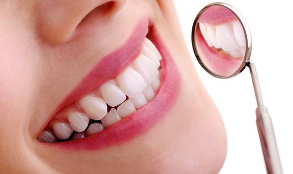 Giá trám răng bằng Amalgam được coi là trám răng giá rẻ nhất hiện nay.