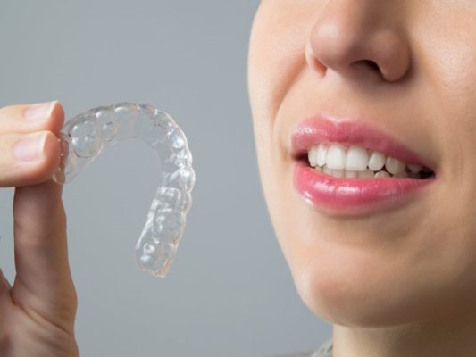 bảng báo giá niềng răng trong suốt