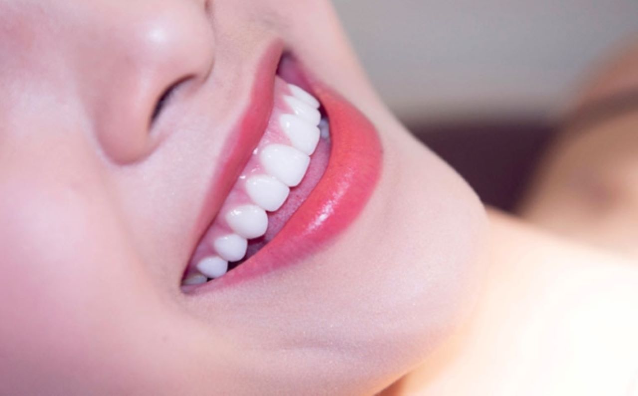 Các yếu tố ảnh hưởng đến chi phí trồng răng sứ vĩnh viễn