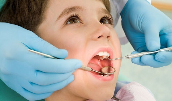 Tại sao các chuyên gia nha khoa khuyên chỉ nên bọc răng sứ từ tuổi 18 trở lên?
