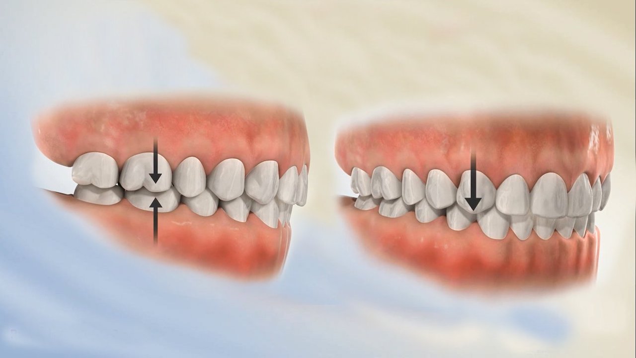 Khớp cắn chuẩn về mặt sinh lý