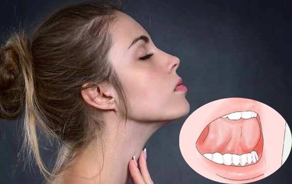 Mewing đúng cách sẽ giúp bạn có khuôn mặt hài hòa hơn