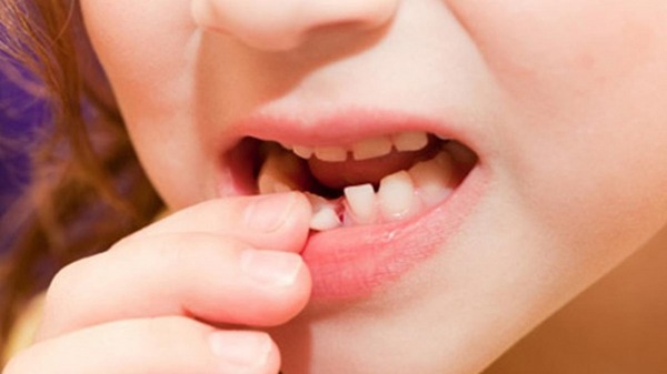 Răng cửa thay thế răng sữa trong khoảng thời gian nào?
