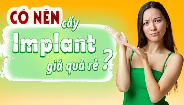 Cấy ghép implant giá rẻ