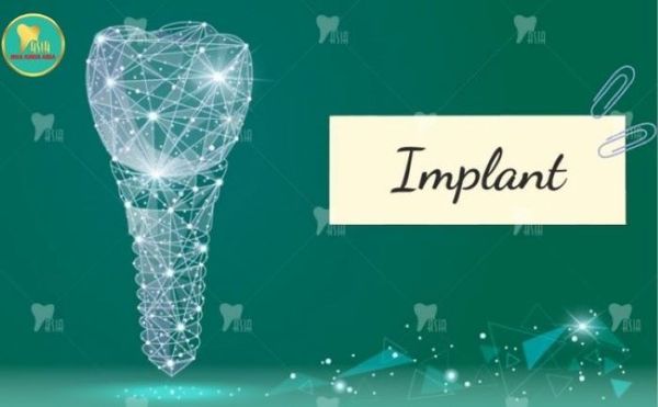 Cấy ghép implant giá rẻ 4