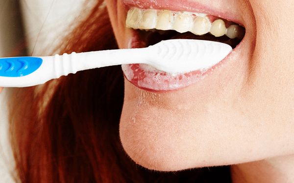 Răng bị ố vàng do quá trình vệ sinh răng miệng không tốt