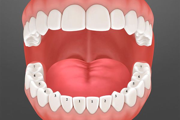 Bảng báo giá thay răng cả hàm tại thủ đức tp hcm