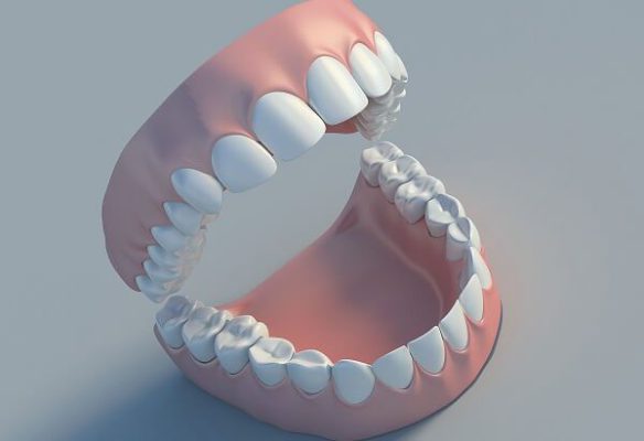 Bảng báo giá thay răng cả hàm tại thủ đức tp hcm 2