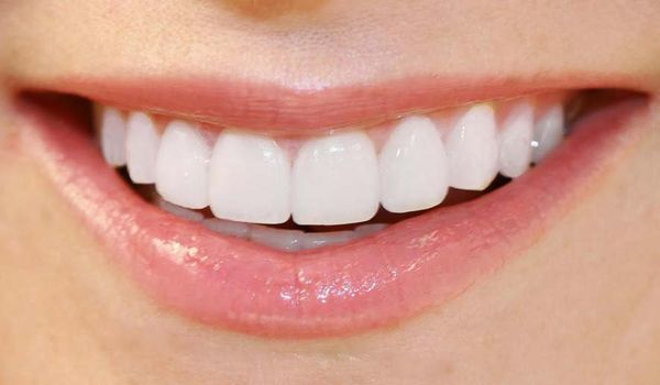 Bảng báo giá thay răng cả hàm tại thủ đức tp hcm 5