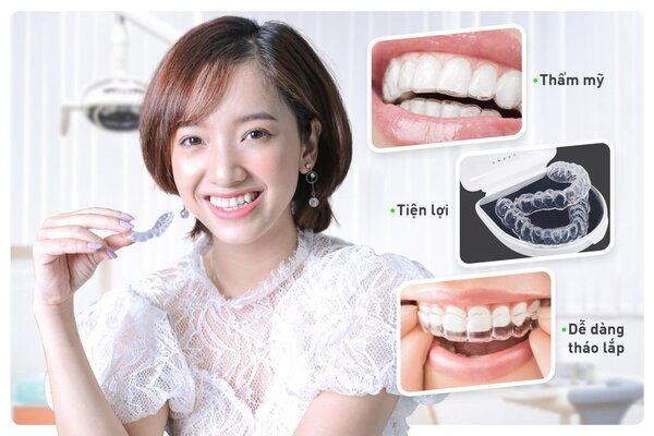 Có rất nhiều yếu tố ảnh hưởng đến giá của niềng răng Invisalign.