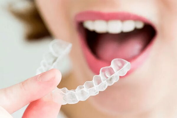 Bất kỳ độ tuổi nào cũng có thể niềng răng Invisalign.