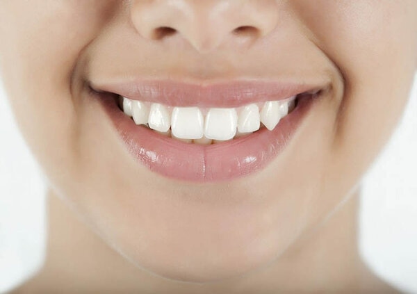 Răng khểnh giúp tự tin hơn trong việc nói chuyện.