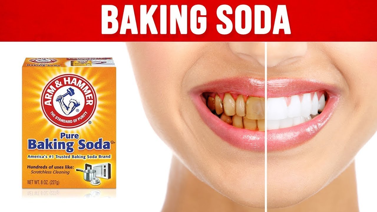 Tẩy trắng răng bằng bột Baking Soda