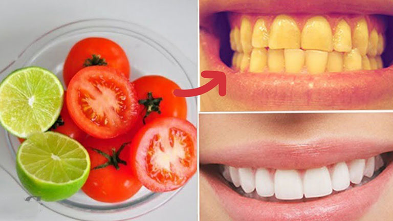 Cách làm trắng răng tại nhà bằng cà chua