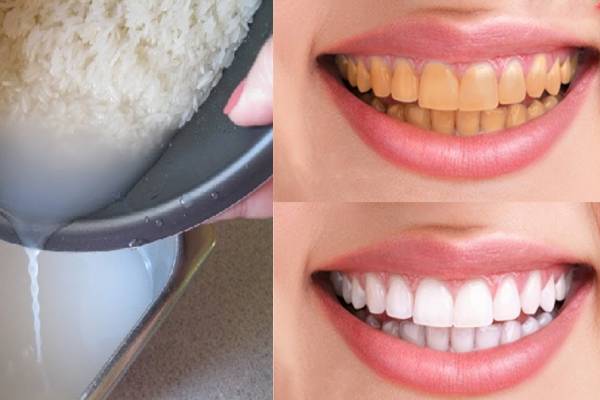 Cách làm trắng răng tại nhà hiệu quả nhất bằng nước vo gạo